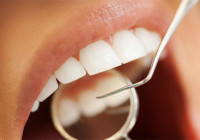 Benarkah Gigi Berlubang Akibat Suka Konsumsi Gula?