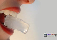 Jika Kamu Kebiasaan Ngunyah Es Batu Hati Hati Itu Bisa Merusak Gigi