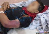 Seorang Suami di Afghanistan Tega Menyiksa Istrinya Yang Sedang Hamil Seorang Suami di Afghanistan Tega Menyiksa Istrinya Yang Sedang Hamil