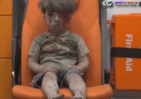 Bocah Tak Berdosa Berlumuran Darah Korban Perang Suriah