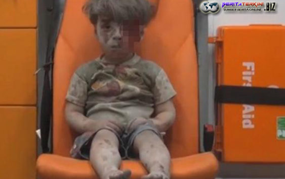 Bocah Tak Berdosa Berlumuran Darah Korban Perang Suriah