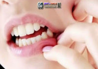 Atasi Sariawan Dengan 6 Cara Yang Mudah Di Bawah Ini