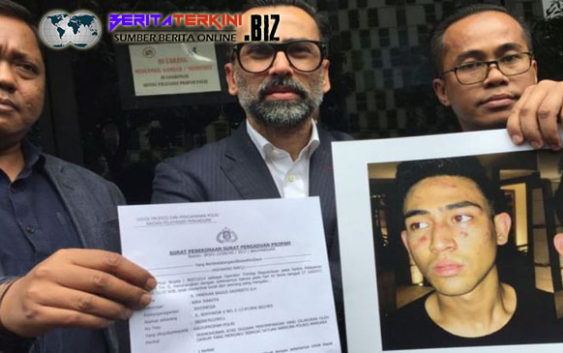 Laporan Yang Diajukan Jeremy Thomas Mengenai Penganiayaan Terhadap Anaknya Diterima Divpropam Polri